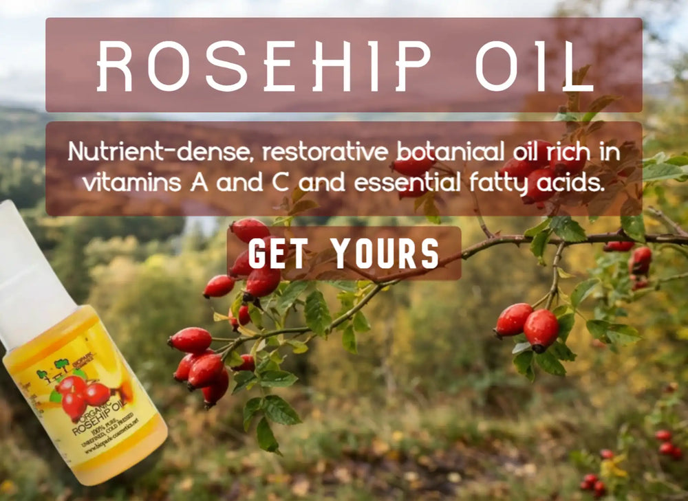 A bottle of rosehip oil shown in the lower left over a blurred outdoor scene of rosehip branches with red berries and text overlays reading 'ROSEHIP OIL' and 'GET YOURS'.